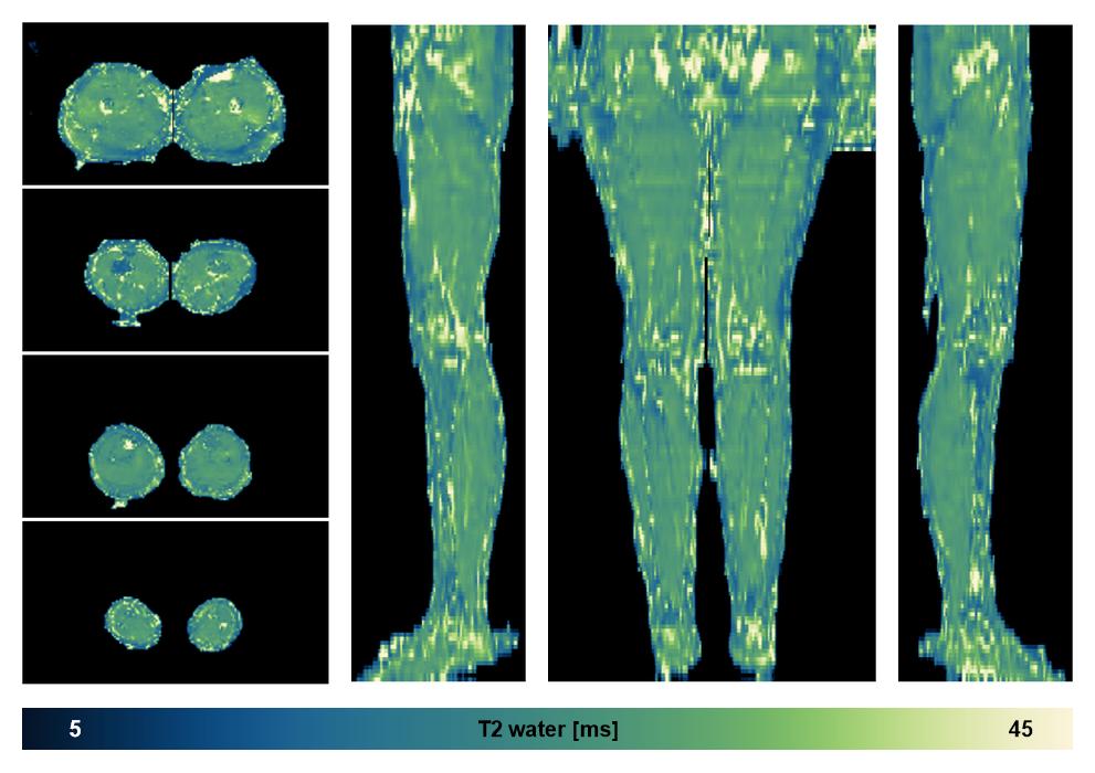 The water only T2 relaxation time of the lower extremity obtained from multi echo spin echo t2 mapping with EPG based reconstruction.